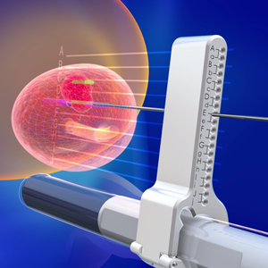 Koelis transperineal biopsy
