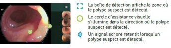 Cad Eye détection VF