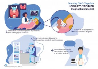 prise en charge nodule thyroide