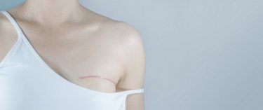 Chirurgie mammaire reconstructrice